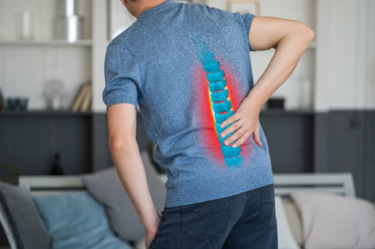 Comment soigner un spondylolisthésis lombaire ?