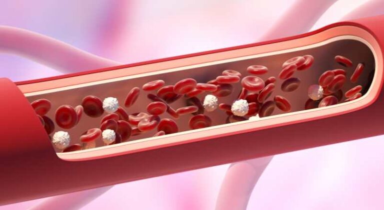 Globule blanc bas et fatigue : comment gérer ?